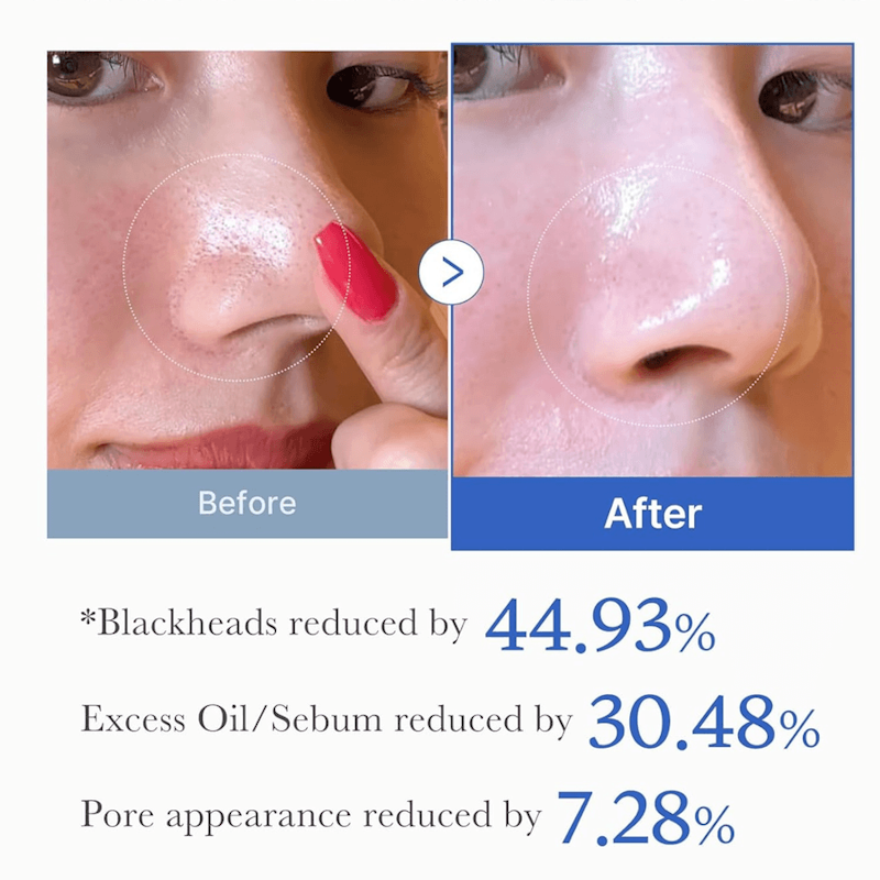 Zero Pore Pad 2.0 Før og Etter - Atlan