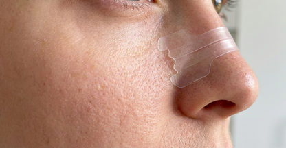 Nesestrips illustrasjon