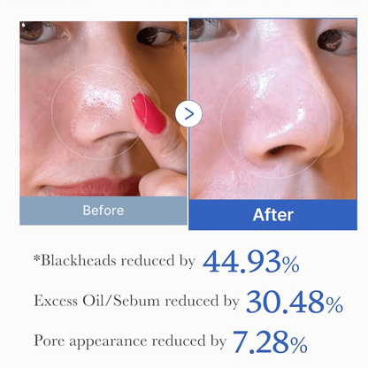 Zero Pore Pad 2.0 Før og Etter - Atlan