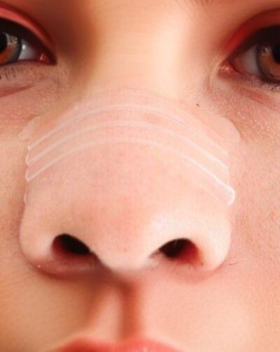 Nesestrips